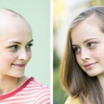 Exploring the Top 10 Online Shops for High-Quality Hair Toppers