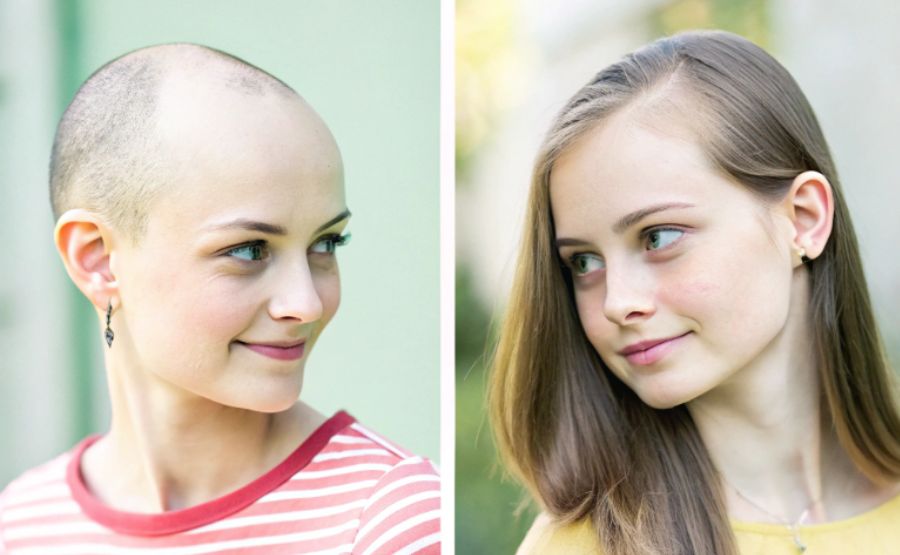 Exploring the Top 10 Online Shops for High-Quality Hair Toppers