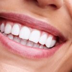 Full Mouth Reconstruction 1 1