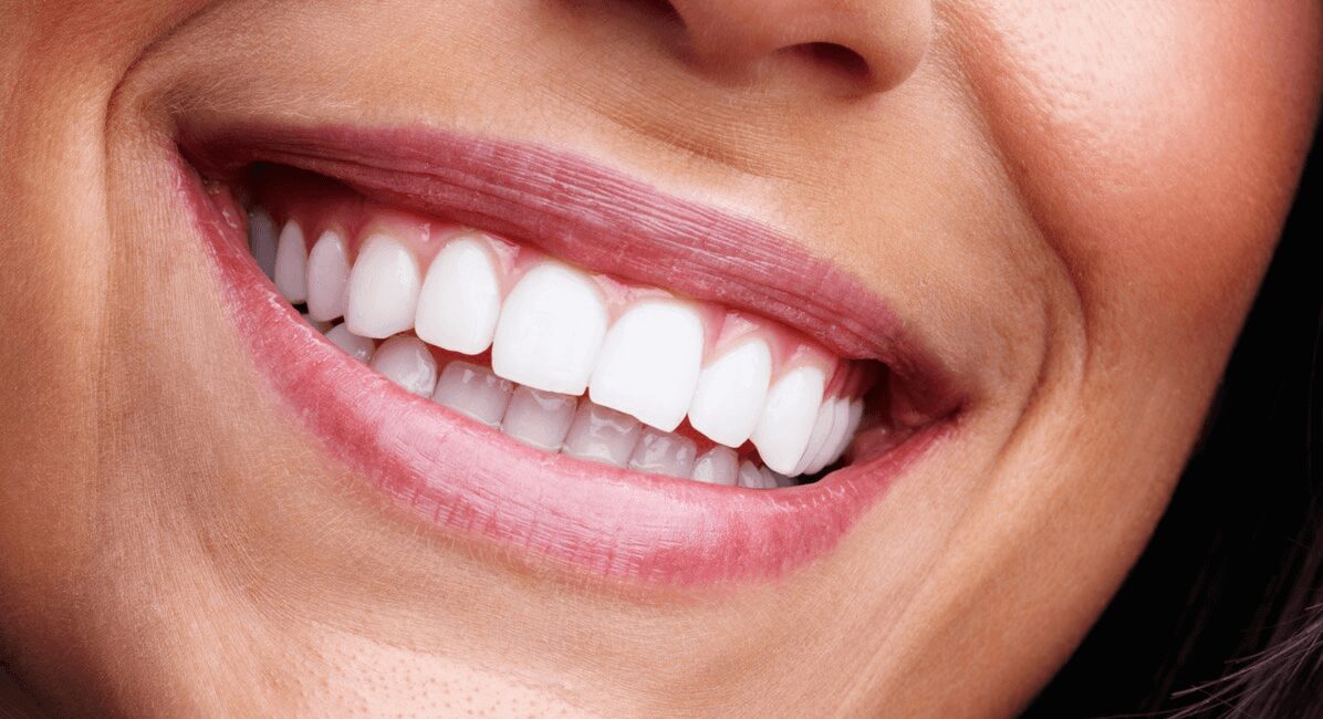 Why Full Mouth Reconstruction Often Involves Implant Dentistry 4 Full Mouth Reconstruction 1 1