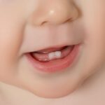 baby teeth 319014bcf7f54fb993d9dd2b1b857622