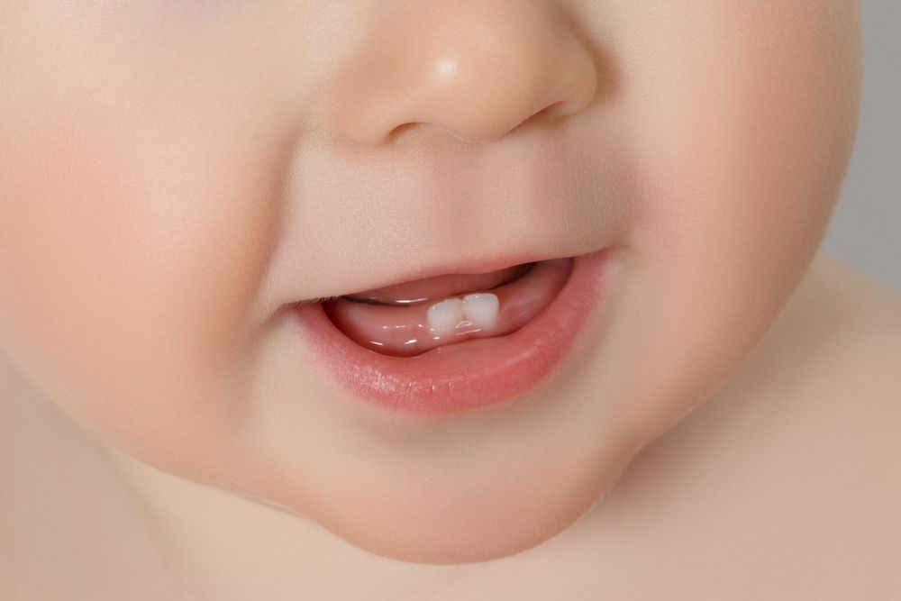 Why Some Baby Teeth Stay In The Mouth Much Longer Than Expected 3 baby teeth 319014bcf7f54fb993d9dd2b1b857622